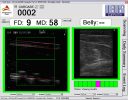 Ultrasound Image Analysis